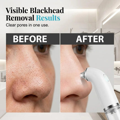 🔥HOT SALE🔥Electric facial cleanser · Lifting and firming · Deep pore cleansing