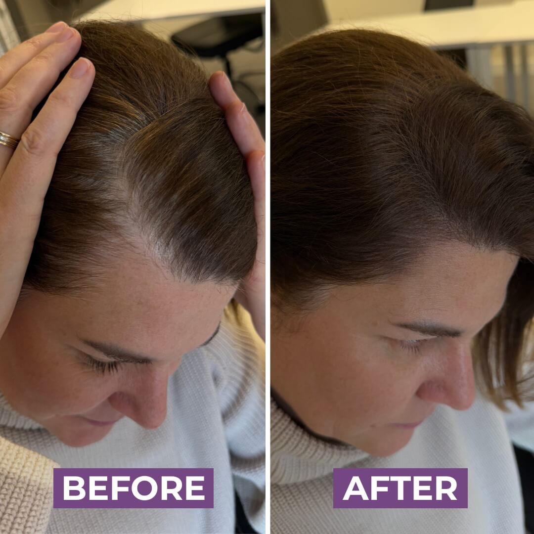HairMagic+ brunette part before and after