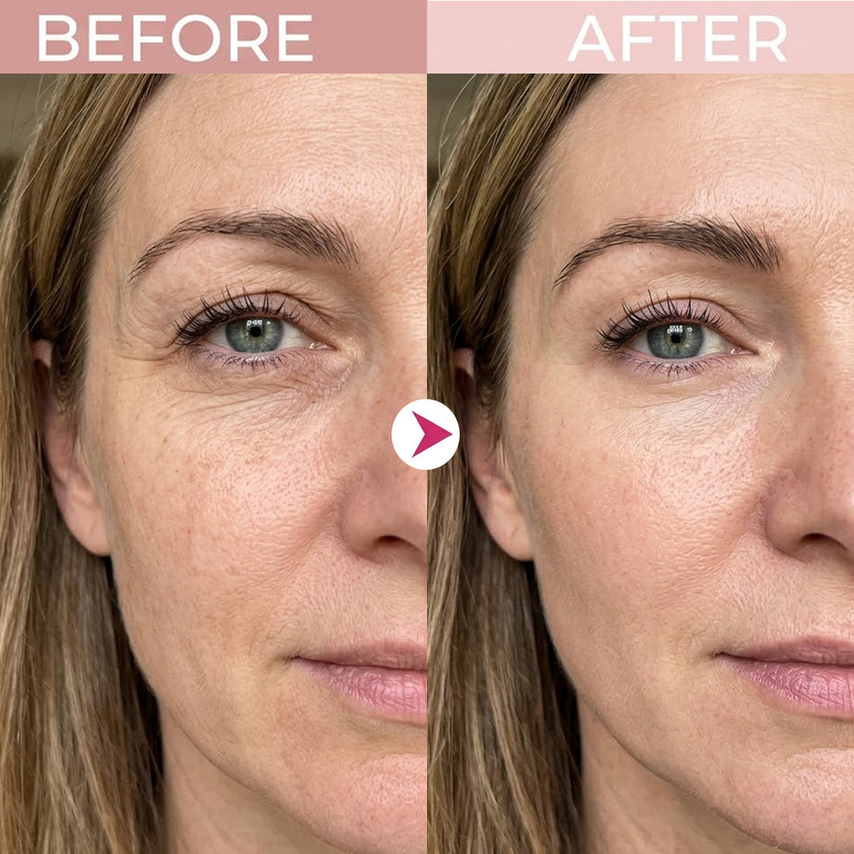 🔥 50% OFF — P7 Eye Renewal Cream for a Smoother, More Hydrated-Looking Eye Area ✨