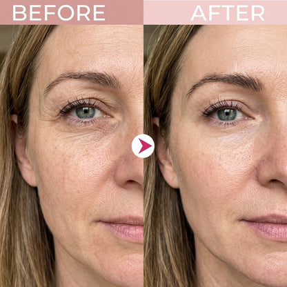 🔥 50% OFF — P7 Eye Renewal Cream for a Smoother, More Hydrated-Looking Eye Area ✨