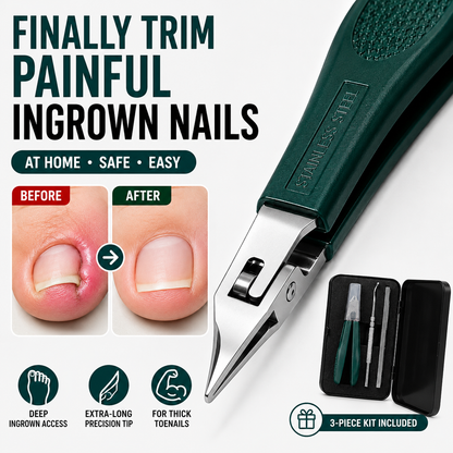 🖐️Last Day 49% OFF🦅Eagle Beak Beveled Nail Clippers | Arthritis-Friendly & Thick Nail Relief