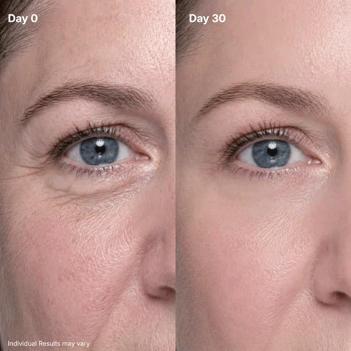 🔥 50% OFF — P7 Eye Renewal Cream for a Smoother, More Hydrated-Looking Eye Area ✨